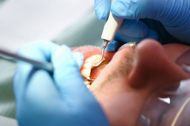 Best Walk-In Emergency Dentist in Lovington, IL