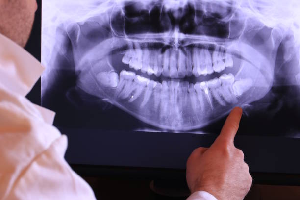 Best Urgent Dental Care in Lovington, IL